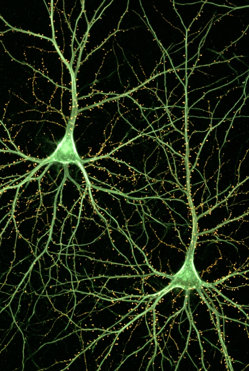 Hippocampal place cells
